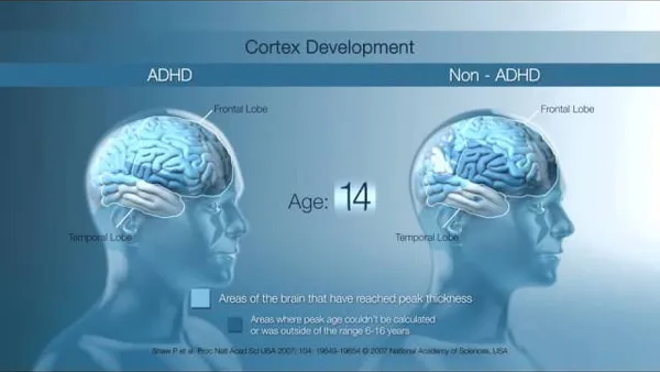 Understanding ADHD and the brain