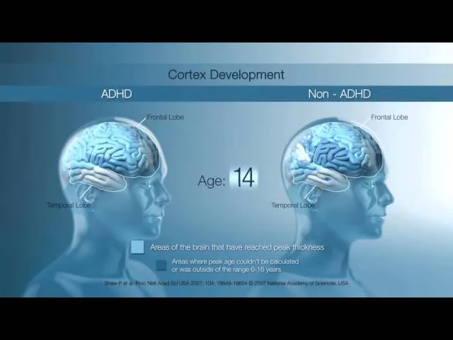Understanding ADHD and the brain